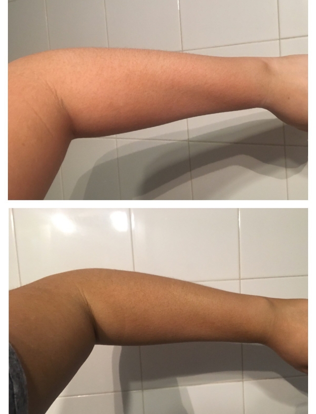Fake tan, two arms, top arm is natural and bottom arm has fake tan applied , ultra dark tan